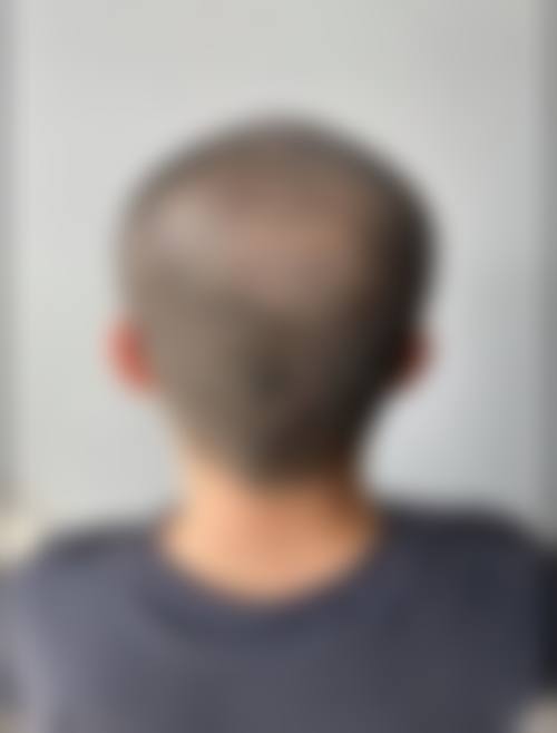 八、厦门碧莲盛植发预约挂号方式及流程