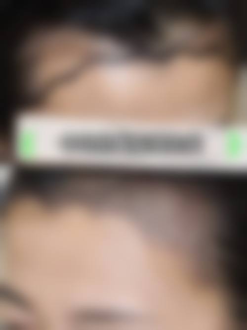 三、厦门碧莲盛植发地址电话营业时间