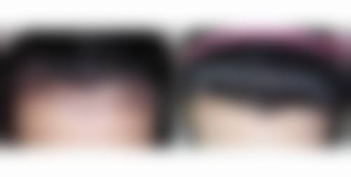 二、厦门碧莲盛植发是正规医院吗?