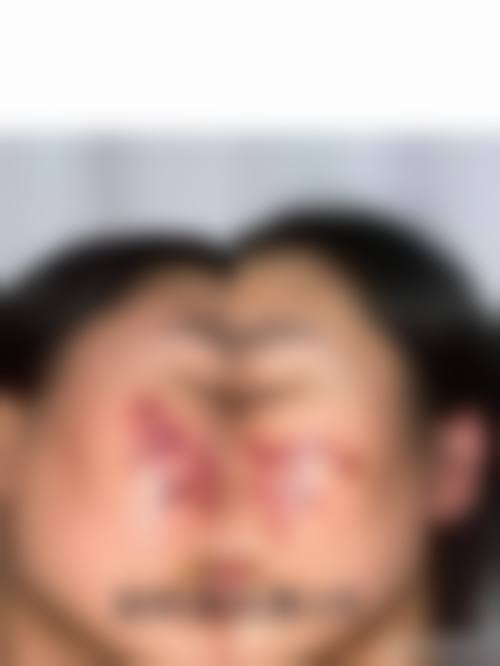 文信荣医生真人实例