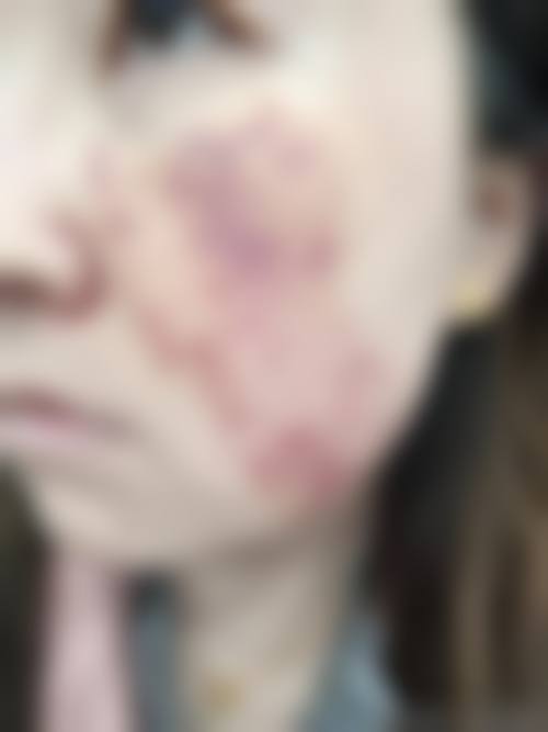 文信荣医生预约挂号