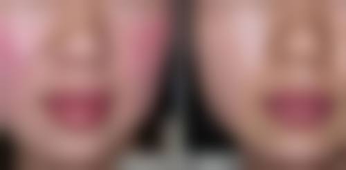 文信荣医生擅长项目