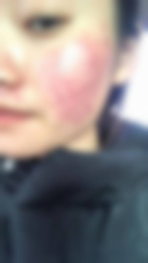 文信荣医生收费价格表