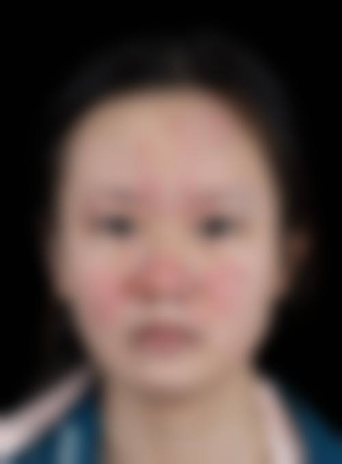 文信荣医生技术优势