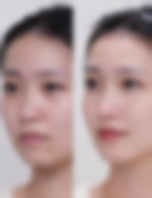 五、石家庄乐氏聚美医疗美容收费价格表