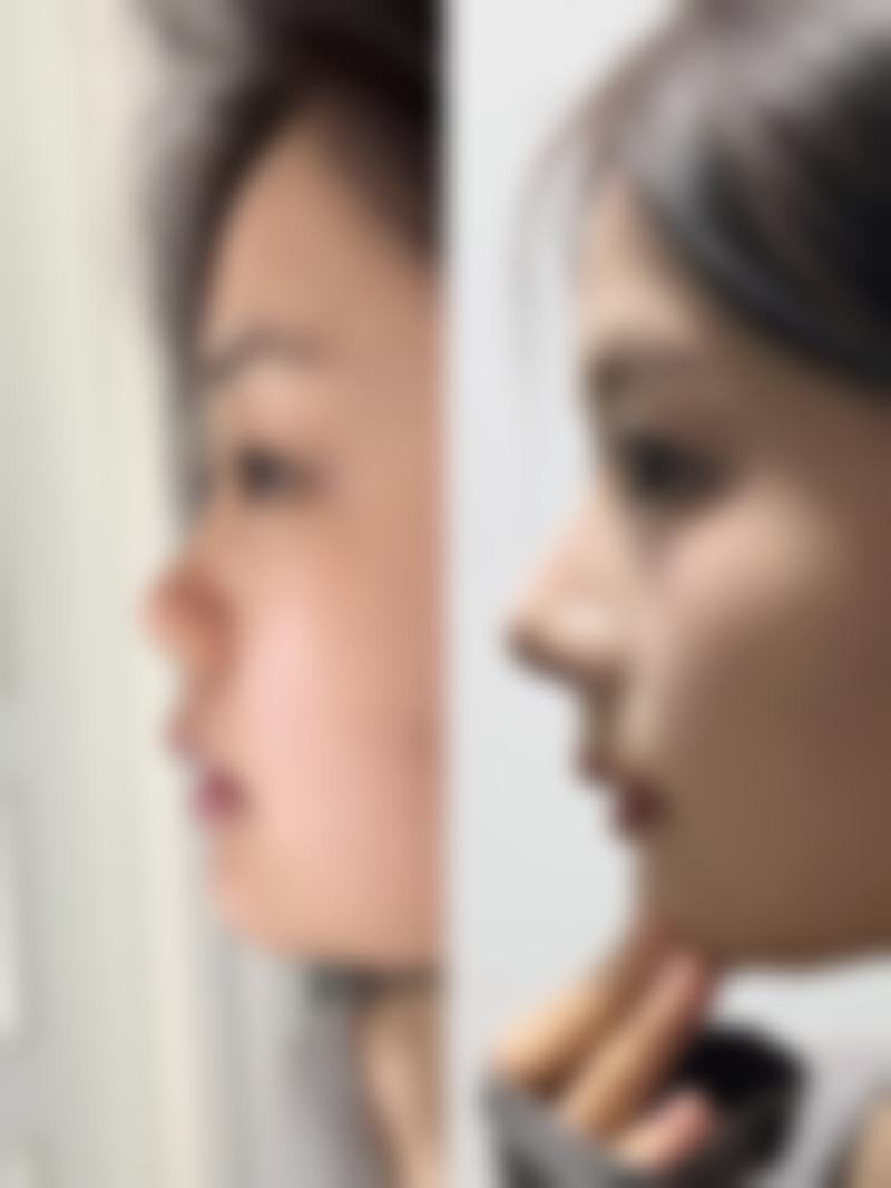 二、昆明博美整形美容医院是正规医院吗？