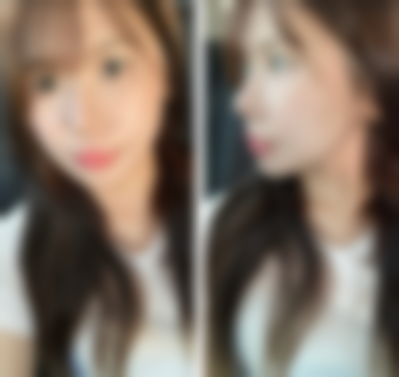 四、kart整形医院特色项目及技术优势