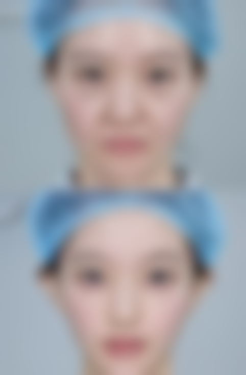 六、南京江宁鼻祖整形收费价格表