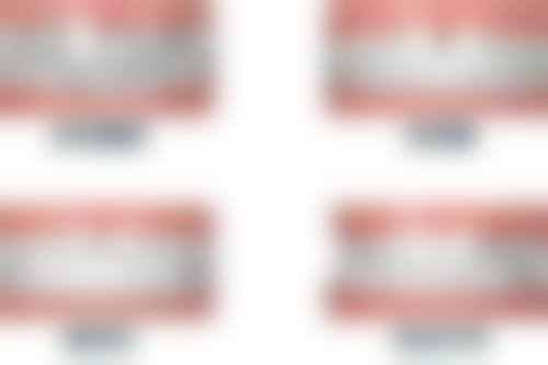 儿童地包天矫正:早期干预成效佳