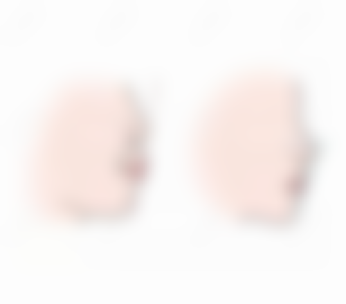 拔牙后修复的选择与注意事项