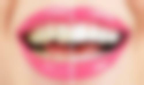 啥情况洗牙加喷砂更必要？