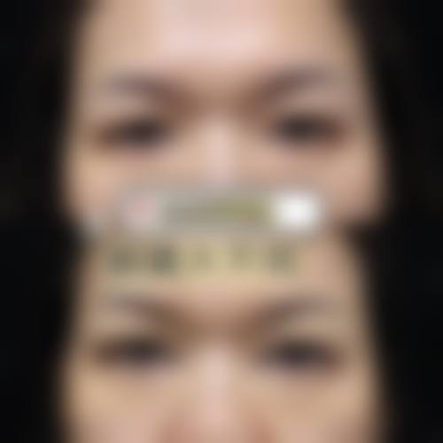 二、大理伊美东方丽人整形医疗美容诊所是正规医院吗