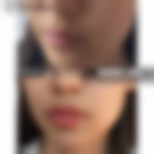 五、韩国YEJUNG HOLIC整形外科医生简介