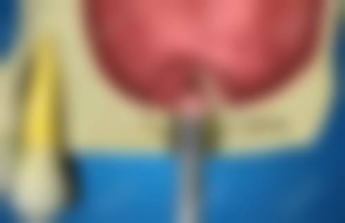 种植牙费用构成