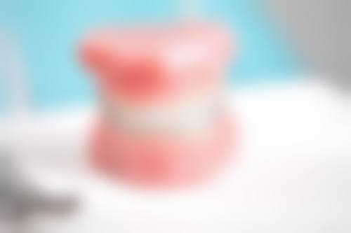 龅牙突出明显，拔牙改善面部侧貌