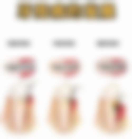 智齿问题频发，拔牙助力前牙排列