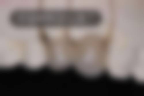 选择镶假牙医生的重要因素