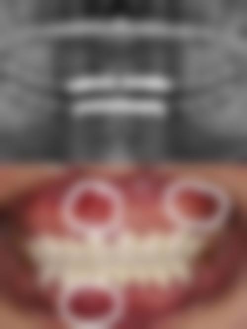 {呼和浩特镶假牙医生在线咨询24小时，专业解答让你告别牙齿烦恼，重拾自信笑容！ 