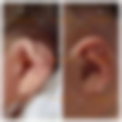 六、韩国YEJUNG HOLIC整形外科收费价格表