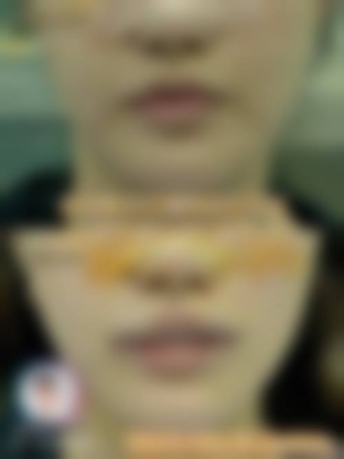 五、珠海懿美医疗美容收费价格表