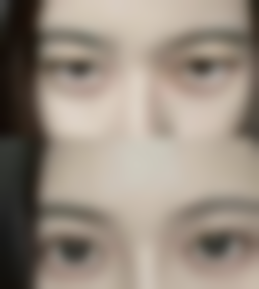 五、北京壹加壹医美尚美容收费价格表