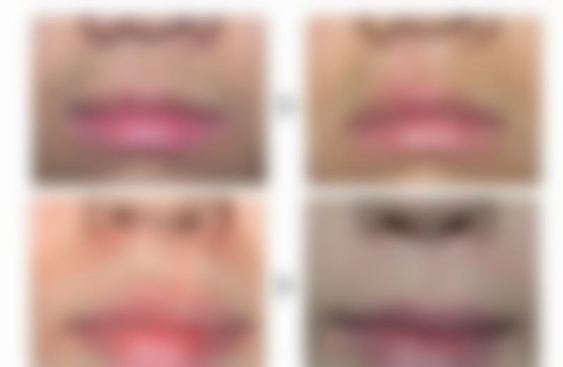 八、韩国YEJUNG HOLIC整形外科预约挂号方式及流程