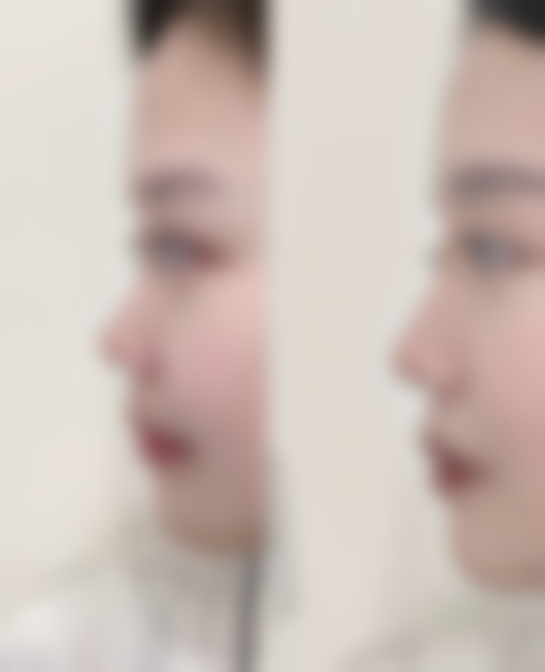 六、北京馨月整形医院收费价格表