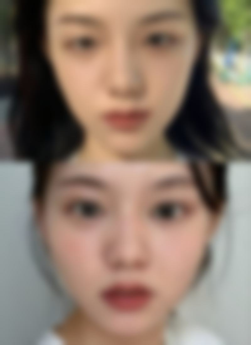 二、北京馨月整形医院是正规医院吗？