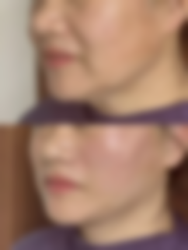 七、韩国YEJUNG HOLIC整形外科口碑怎么样