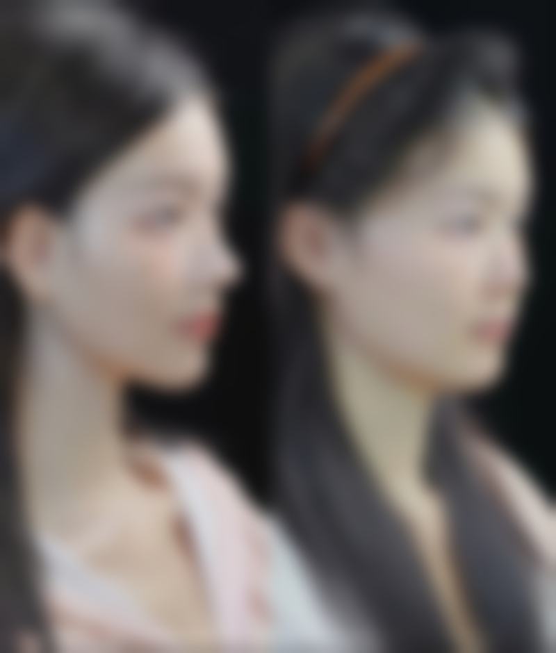 七、北京馨月整形医院口碑怎么样？