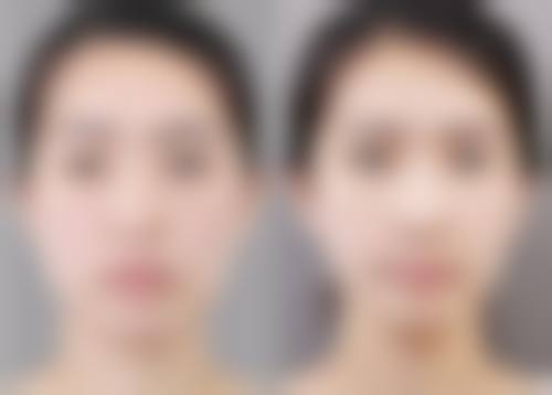 四、丽水小榕丽整形医院特色项目及技术优势