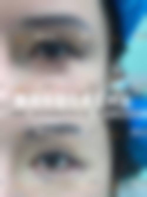 五、南昌蓝乔整形医院收费价格表