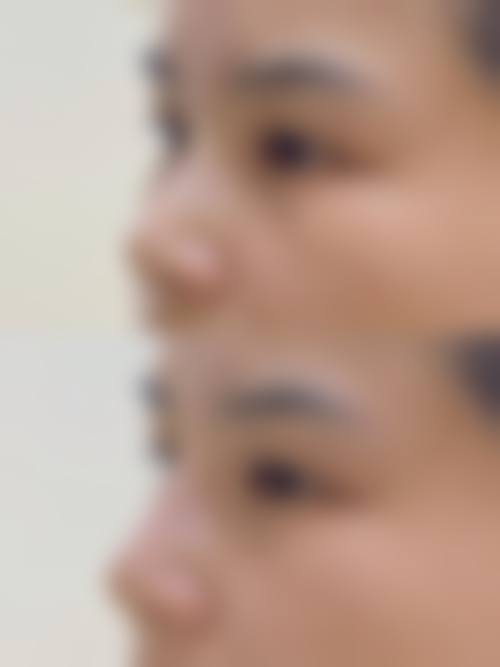 二、珠海科美医疗美容整形门诊部是正规医院吗