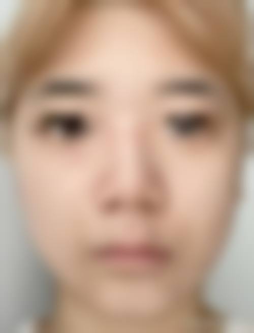 八、沈阳市第一人民医院整形科预约挂号方式及流程