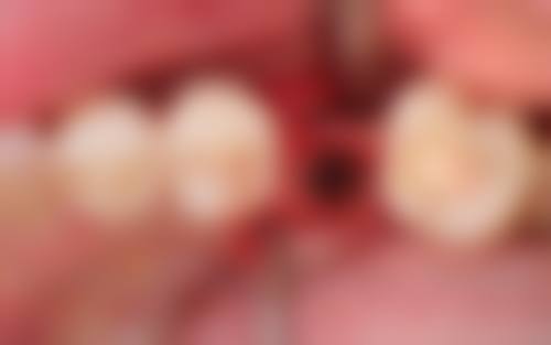 兰州皓亚口腔医生特色