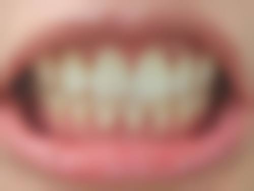 其他口腔项目情况