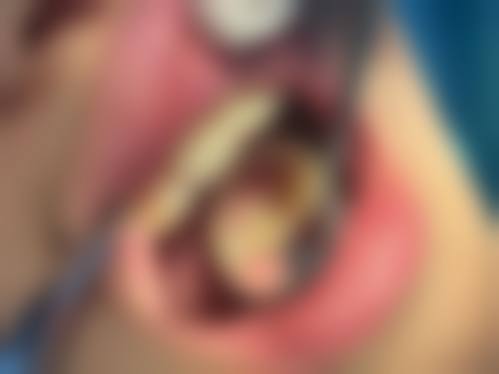 {辽宁拔牙24小时在线咨询：知名医院专家、预约方式及拔牙注意事项全攻略 