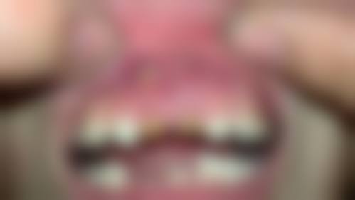 如何选择适合自己的牙科机构？