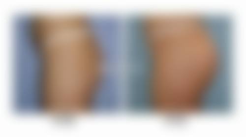 六、成都新华医院整形美容中 心收费价格表