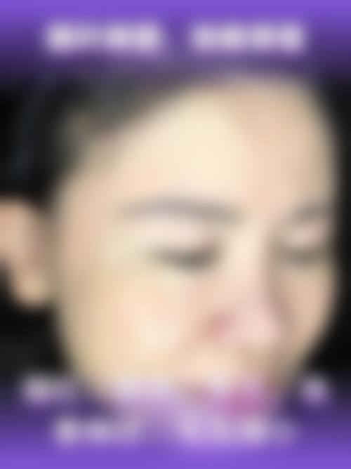 六、重庆北城颜所整形医院口碑怎么样？