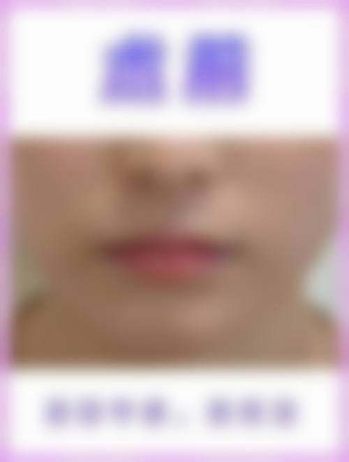 六、北京百达丽俯大整形医院口碑怎么样?