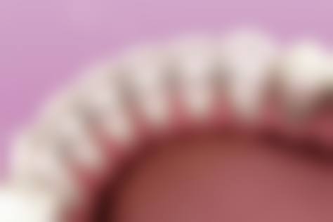 想做滨州隐形矫正？医生24小时在线咨询，揭秘本地矫正机构价格与技术亮点！ 