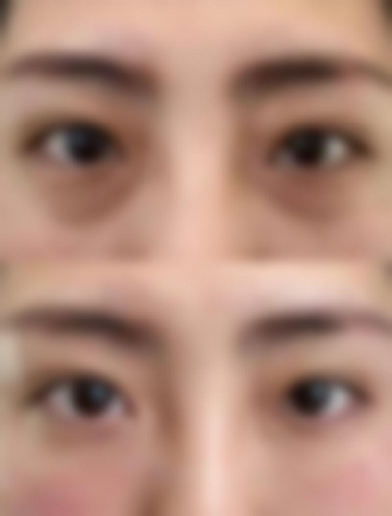 五、武汉维纳斯医疗整形医院收费价格表