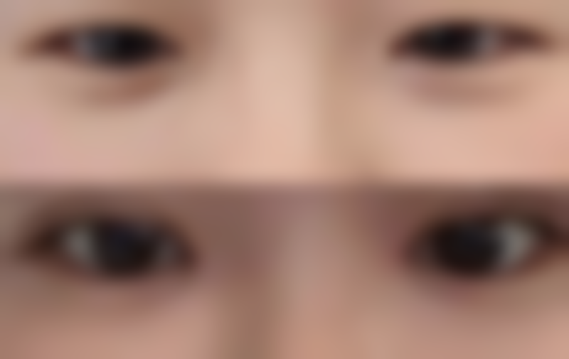 五、北京百达丽俯大整形医院收费价格表