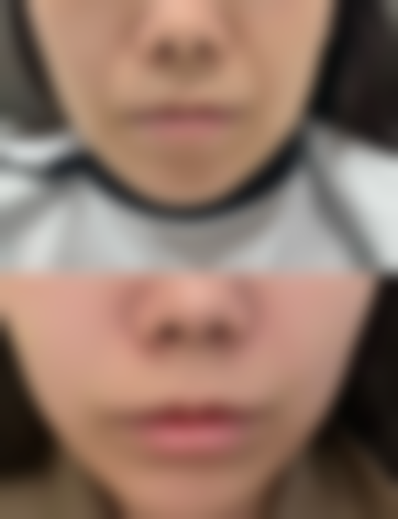 四、厦门金贵香（原思明福华）整形医院特色项目及技术优势