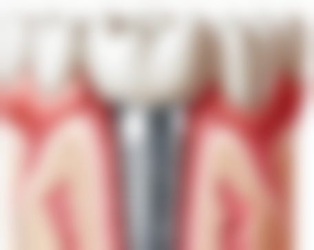 耐用性能大比拼,谁能更胜持久战?