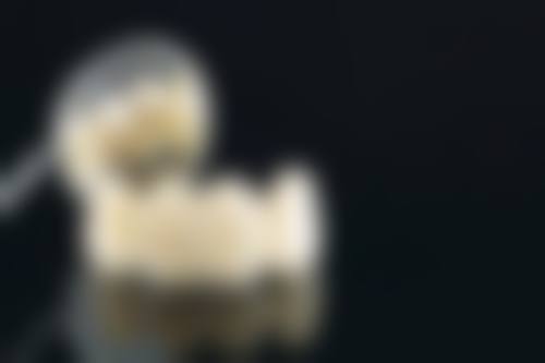 个人习惯对烤瓷牙胶水寿命的影响