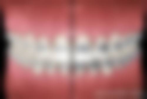 21岁做牙齿矫正，矫正方案怎么选