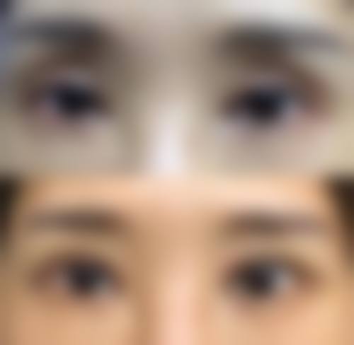 六、潍坊溯本整形医院口碑怎么样？