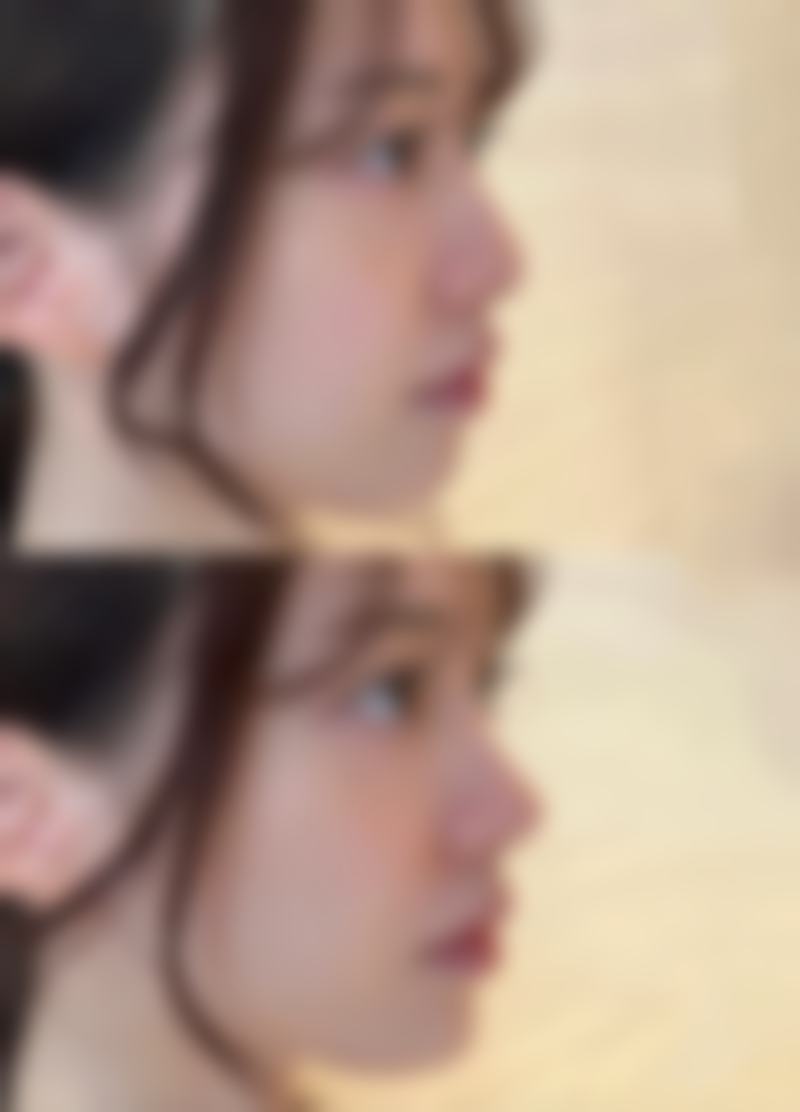 四、潍坊溯本整形医院特色项目及技术优势